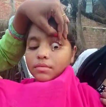 Doktor bingung gadis alami air mata beku, menangis keluar 15 ketul batu dari kelopak mata. Seorang remaja perempuan telah menggemparkan orang ramai kerana tidak mengeluarkan air mata ketika menangis, sebaliknya ketulan batu.