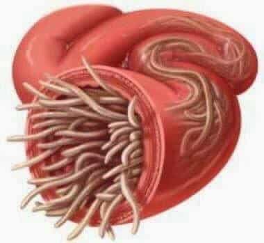 Cara mudah nak hilangkan cacing pada kanak-kanak, bahannya pun ada di dapur