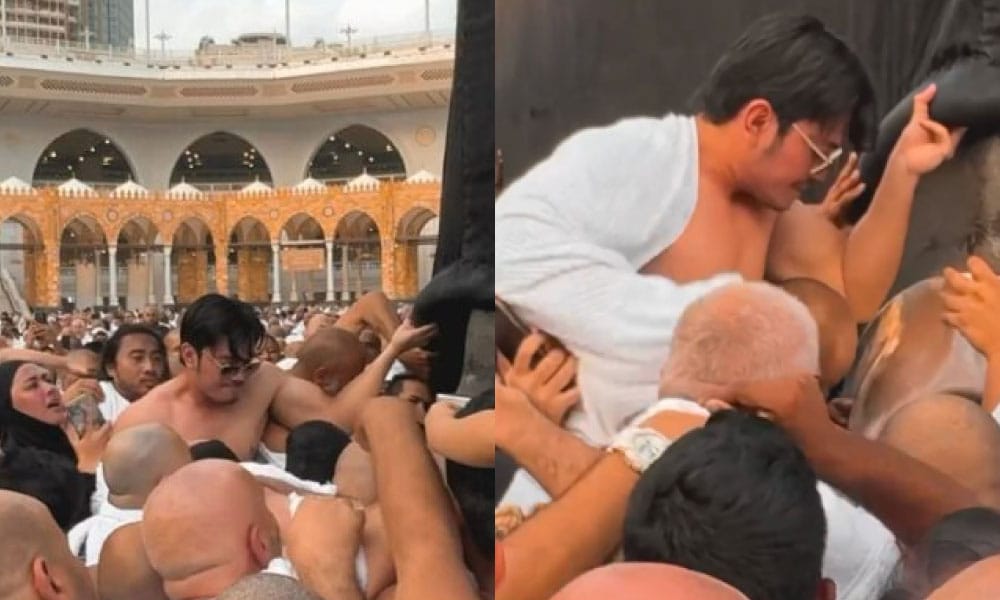 'Belakang badan dia banyak ruam', ada hikmah juga dia rakam video bersesak mahu cium Hajar Aswad