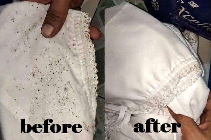 Tahi lalat penuh di baju Jangan risau ini cara betul untuk hapuskan