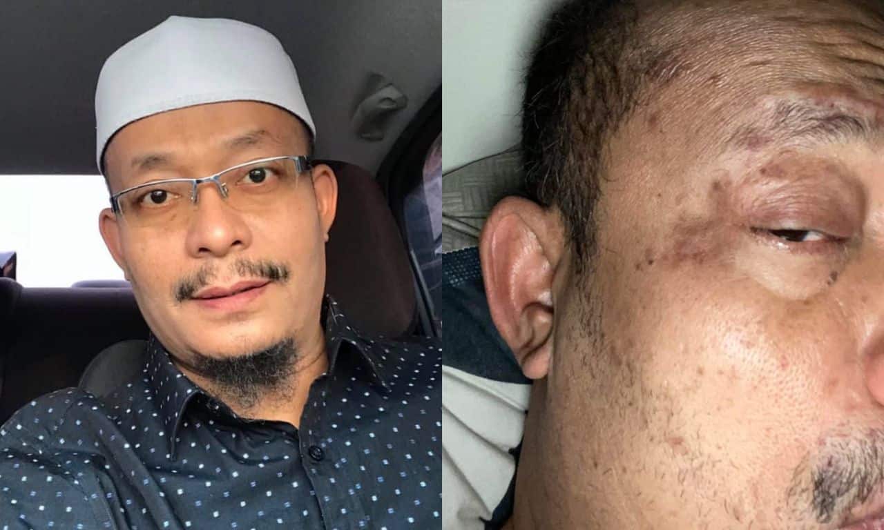 Disihir sejak 1997, Ustaz Kazim sakit & susah tidur, makan pun kena 'pantang'
