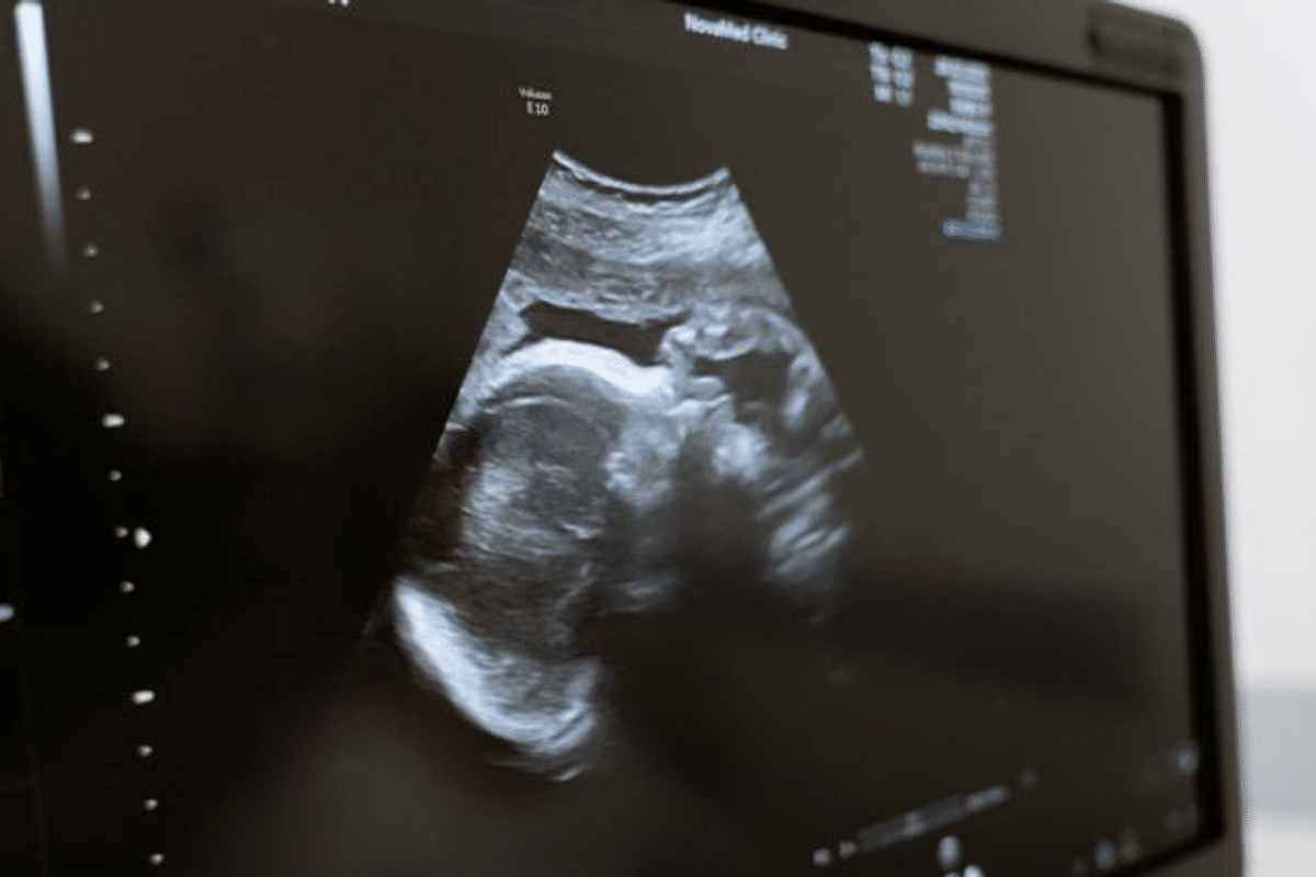 Ini rupanya sebab bayi banyak menendang