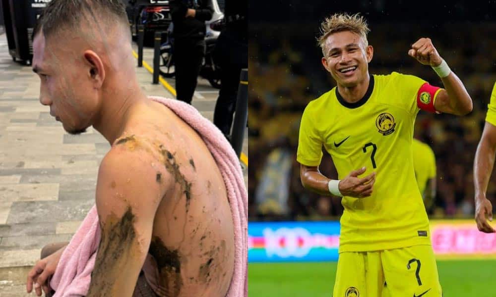 Lagi kes babitkan pemain bola, Faisal Halim disimbah asid ketika main ‘go cart’