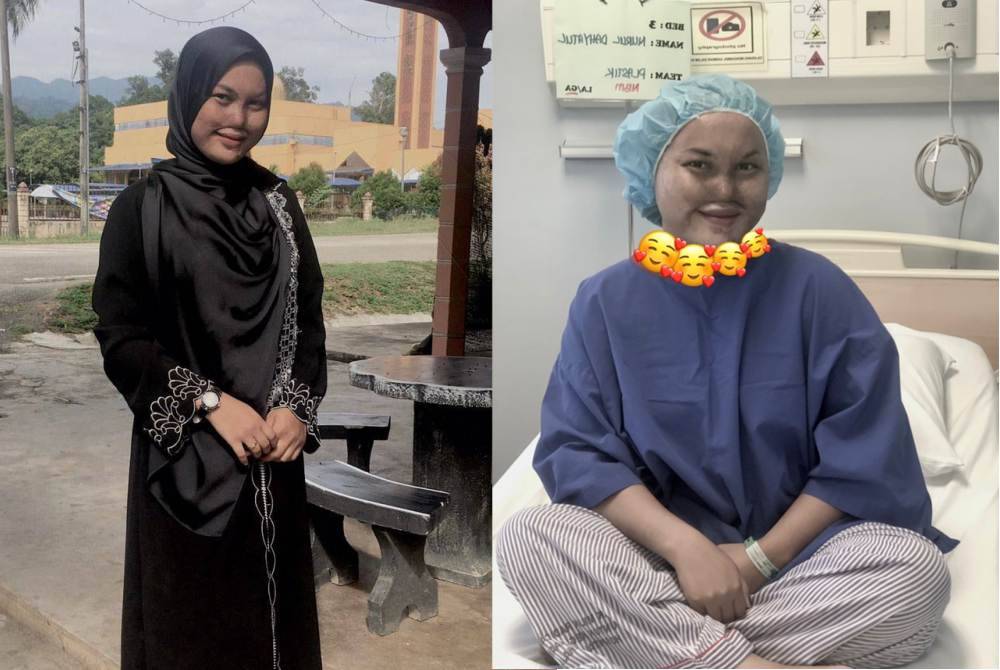 "Saya tak pernah berdendam" - Ayah & ibu bergaduh, anak jadi mangsa simbahan asid