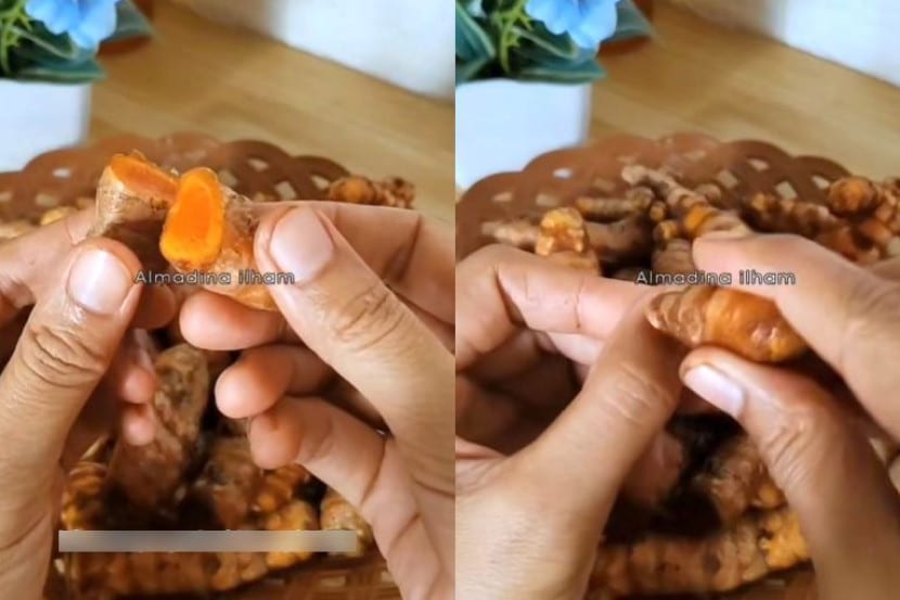 Sebelum pergi hospital, cek dulu sistem pencernaan badan guna kunyit hidup, gosok-gosok je!