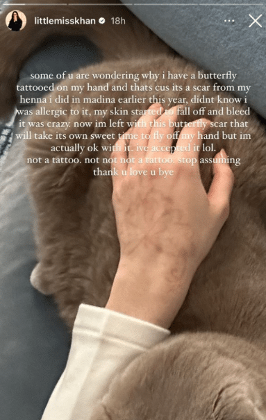 Tular 'tattoo' di tangan, ini jawapan Ameera Khan