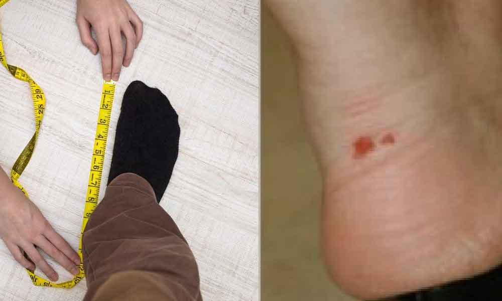 Jangan salahkan kasut bila kaki melecet, ini cara betul ukur kaki ramai tak tahu