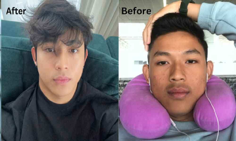 Pemuda ini kongsi tips jaga kulit muka dengan satu cara saja