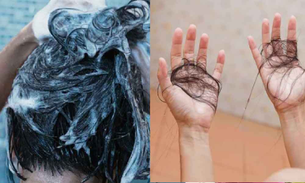 Rupanya salah teknik ketika syampu punca rambut gugur – Pakar