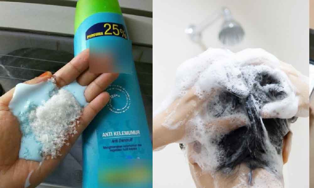 Masalah rambut gugur, kulit kepala gatal boleh selesai... tapi kena tambah satu bahan ini